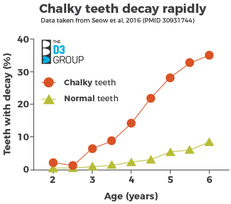 Chalky teeth decay rapidly graph Chalky teeth decay rapidly graph
